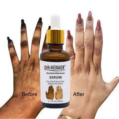 Hand Brightening Moisturizing Lotion South Africa India - ProTrendyz